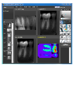 Dental xray panel